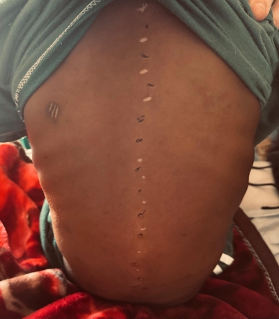 Cuando la Piel Habla